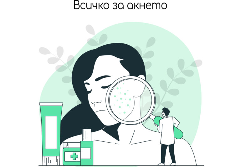 акне-въпроси-и-отговори