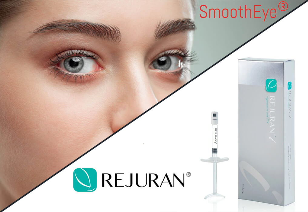 fotona-smooth-eye-rejuran-i